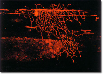 Fluorescent Protein Expression in Zebrafish Embryos