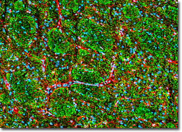 Striatum