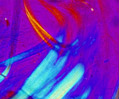Short Asbestos Fibers