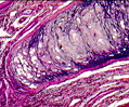 Epiglottis Elastic Cartilage
