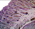 Fetal Elastic Cartilage
