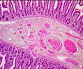 Human Lower Duodenum