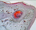 Human Fingernail Development