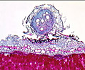 Legume Nodules