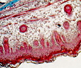 Fetal Skull Membranous Bone
