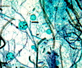 Mixed Green Algae