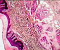 Palm and Sole Skin