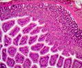 Peyer's Patches