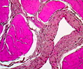 Primate Bladder