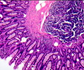 Primate Colon