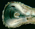 Human Tooth Root