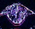 Metridium