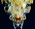 Human Head Louse