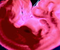 Pig Embryo