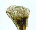 Canine Hookworm