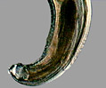 Canine Nematode (Toxocara canis)